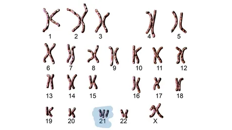 Image depicting the karyotype of humans with aneuploidy (trisomy) of chromosome 21.