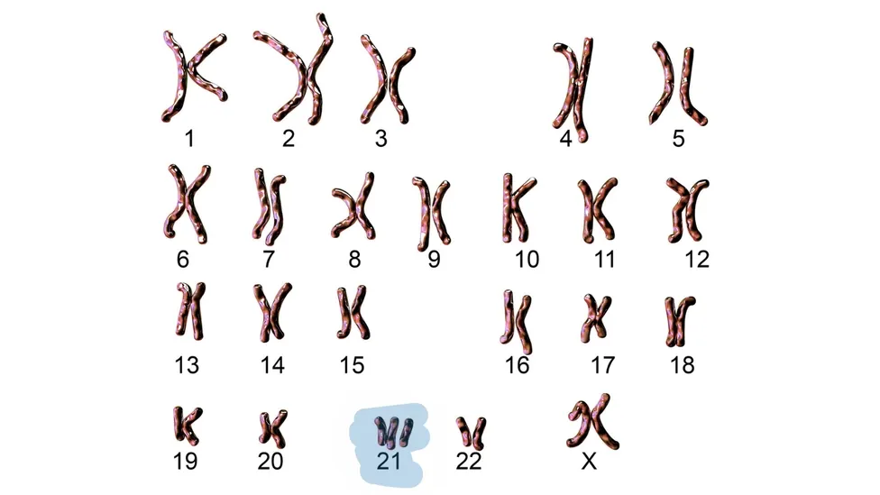 Image depicting the karyotype of humans with aneuploidy (trisomy) of chromosome 21.